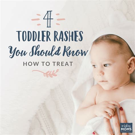 4 Toddler Rashes You Should Know How To Treat Toddler Rash Baby Rash