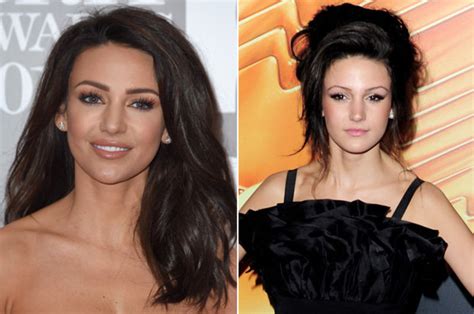 Michelle Keegan New Look Plastic Surgeon Gives Verdict Amid Talk Of Botox And Lip Fillers