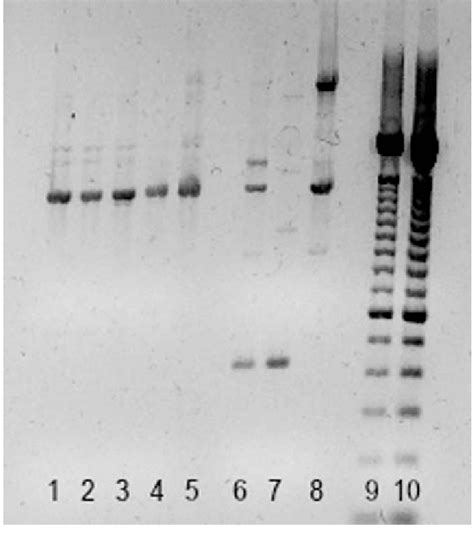Random Amplification Of The Polymorphic Dna Rapd Pcr Using The 1283