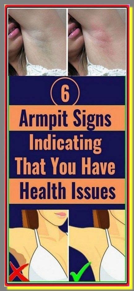 6 Armpit Signs Indicating That You Have Health Issues Sweating Too Much