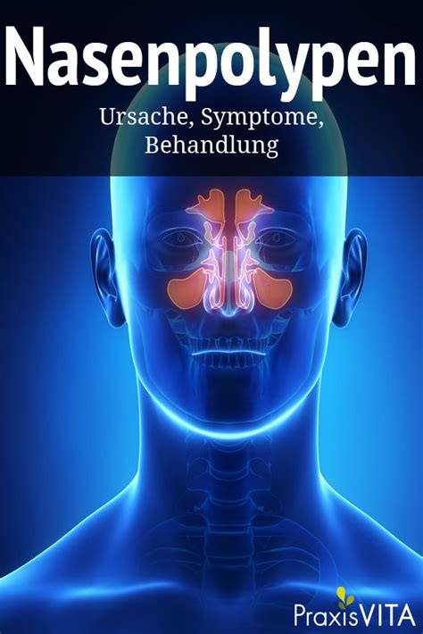 Was sind Nasenpolypen? | Nase, Nasennebenhöhlen, Gesundheit und schönheit