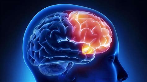 Brain Diseases 10 Common Brain Diseases