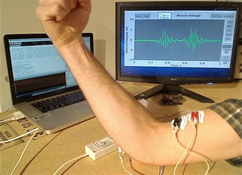 Flexvolt An Emg Sensor For Physical Therapy And Biohacking