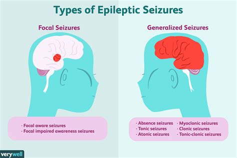 Epilepsy Types