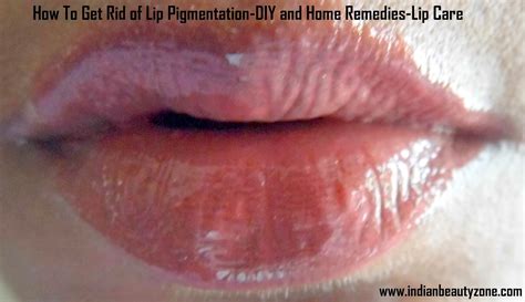 Bhas and tretinoin are the only things that really have an effect of blackheads/sebceous filaments (yours appear to be sfs). Reiki healing and its benefits, get rid of lip sores fast ...