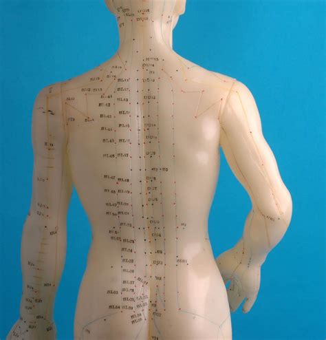 Acupuncture Therapy At Taunton Chiropractors Centre