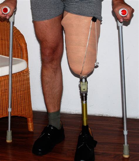 Pretender Prosthetic Leg For Simulating A Left Above Knee Amputation