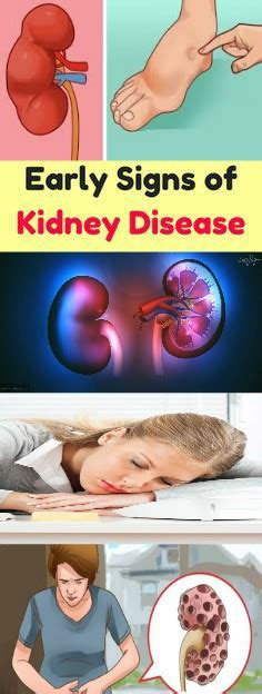 Healthbeauty Early Signs Of Kidney Disease And How To Prevent The