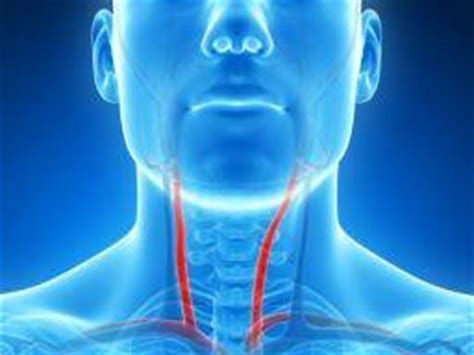 Damage to these arteries pos. Narrowing of the carotid arteries may lead to memory and thinking problems