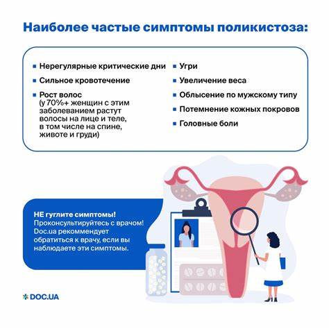 Поликистоз яичников и диета Как забеременеть при поликистозе яичников Как забеременеть при поликистозе яичников Поликистоз яичников и диета