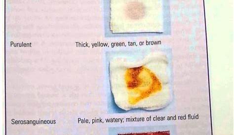 Surgical Drain Color Chart