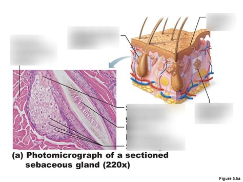 Photomicrograph Of A Sectioned Sebaceous Gland Diagram Quizlet