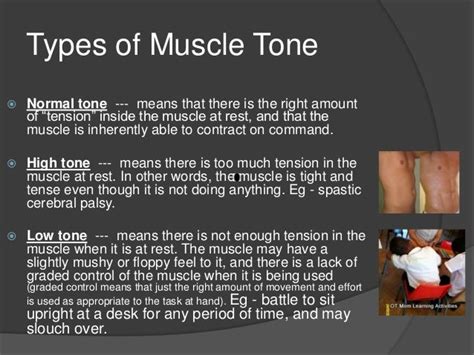 Muscle Tone Pbl Mbbs
