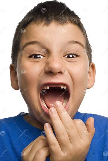 Boy Missing Teeth Stock Photo Image Of Hygiene Dentistry 20914686