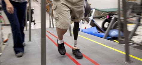 Vas ‘grand Challenge Open Source Prosthetic Limbs For Veterans