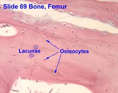 These cylinder shaped structures are called osteons or haversian systems. The Quest for Height: Grow Taller | Increase Height | Bone Size: A histological analysis of the ...