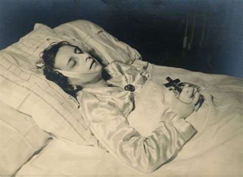 Post Mortem Photo Of A Young Lady Laid Out In Bed At Home
