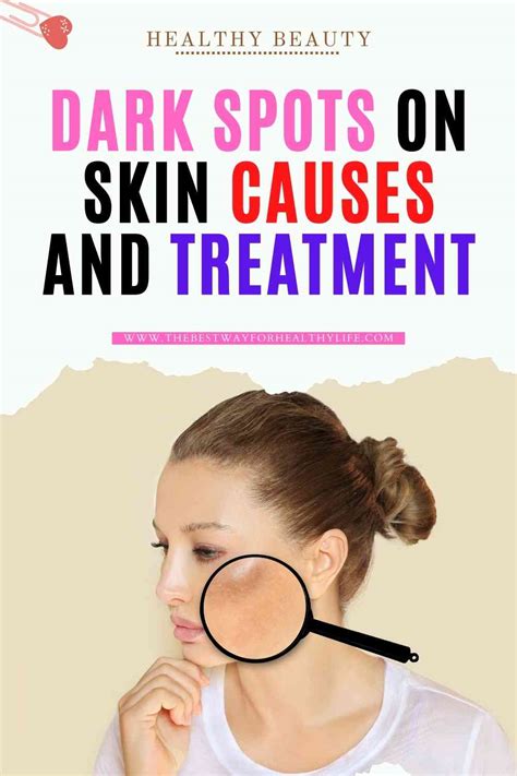 Dark Spots On Skin Causes