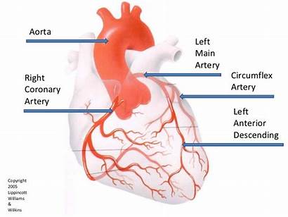 Coronary Arteries Artery Heart Left Anatomy Angiography