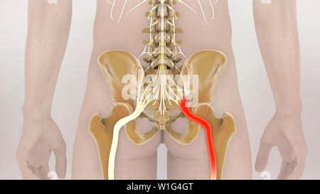 Sciatic Nerve Pain D Illustration Stock Photo Alamy