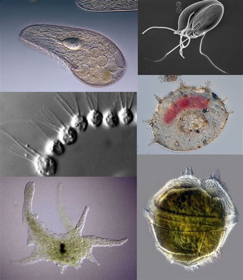 4 Main Groups Of Protozoa Protists Scanning Electron Micrograph