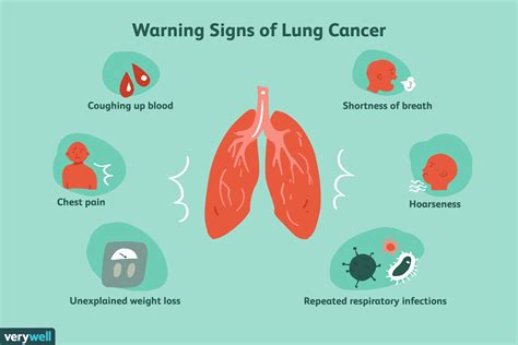 Lung Cancer Symptoms Coughing Up Phlegm Cancerwalls Vrogue Co