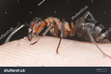 Angry Ant Biting Human Skin Extreme Stock Photo 98179784 Shutterstock