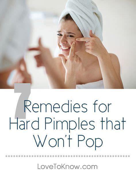 How To Prevent And Get Rid Of Hard To Pop Pimples Pimples Under The