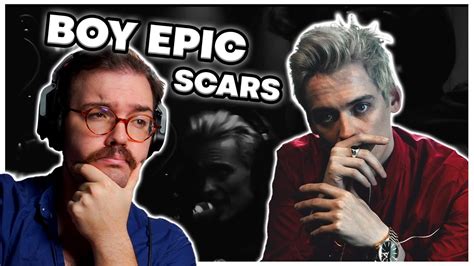Twitch Vocal Coach Reacts To Boy Epic Scars Youtube