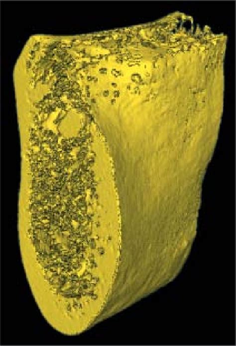 The bird bone is much lighter. Micro-CT image of human mandibular bone. The cross-section ...