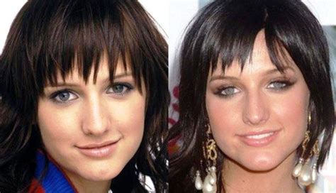 Ashlee Simpson Nose Job Before And After Photos Nose Job Ashlee Simpson Bad Nose Jobs