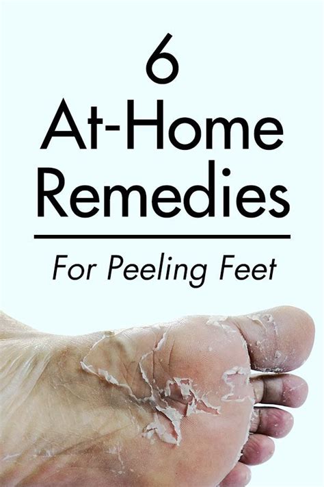 Peeling Skin On Feet Why Your Feet And Toes Are Peeling Own Harmony