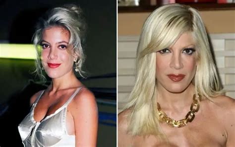 Tori Spelling Every Plastic Surgeries And Matching Tattoos With Her Husband