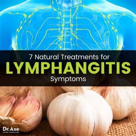 Lymphangitis Signs 7 Natural Treatments For Symptoms Dr Axe