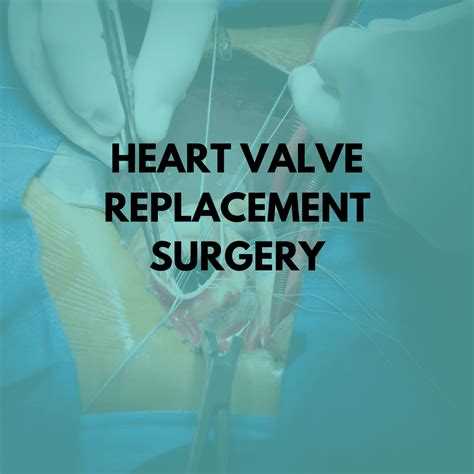 Heart Valve Surgery Why Is It Performed Niruja Healthtech