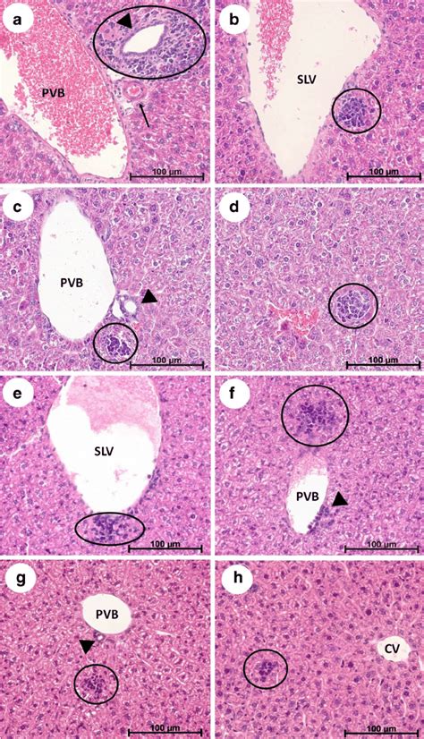 Liver Histology Bile Duct