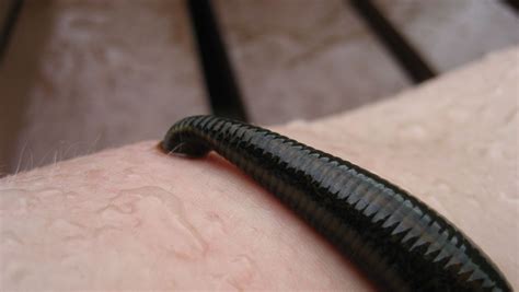 Bloody Suckers Leech Therapy Nature Pbs