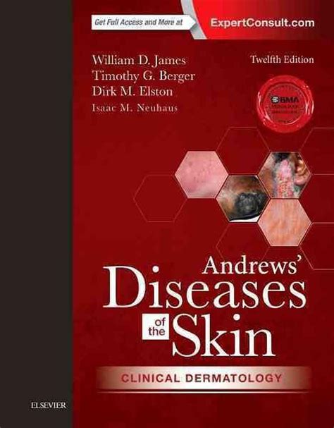 Andrews Diseases Of The Skin Clinical Dermatology Edition 12