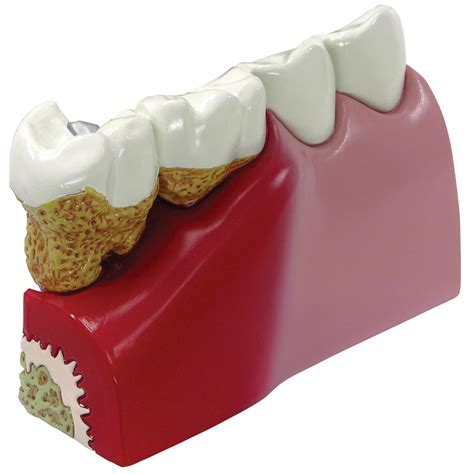 Teeth Model 1019539 2860 Anatomical Tooth Models Anatomy