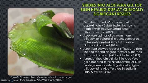 Aloe Vera Therapeutic Use And Its High Efficacy In Burn Treatment