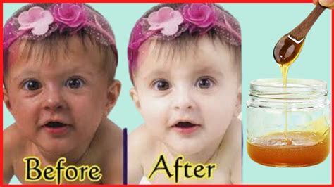Babies Skin Whitening Permanently How To Get Fair Skin For Your