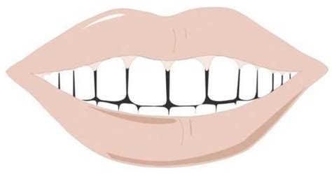 There are many companies that manufacture invisible braces, invisalign being the most popular choice. What are the Causes of Gaps in Teeth? - Dentistry Book