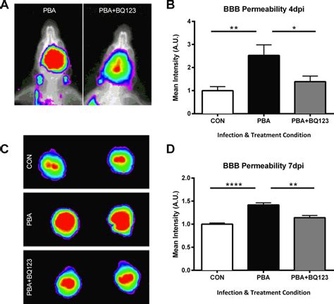 Administration Of BQ123 Inhibits Vascular Leakage In PbA Infected