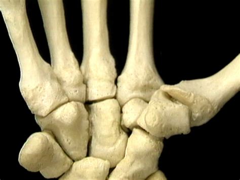 Huesos Y Articulaciones Del Carpo Y La Mano Acland Video Atlas De