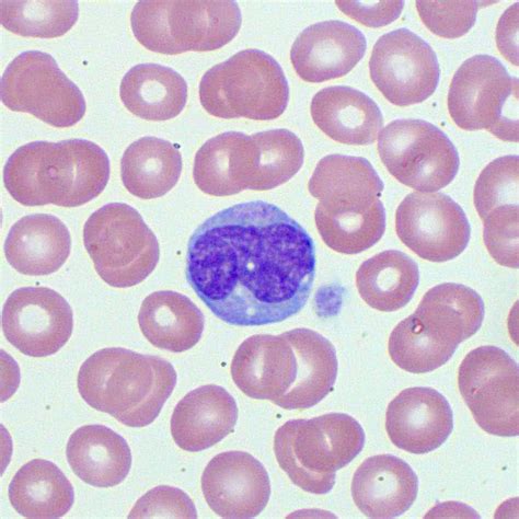 Monocytes Blood Film Medschool
