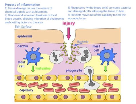 Proteolytic Enzymes And Inflammation — Grassroots Physical Therapy