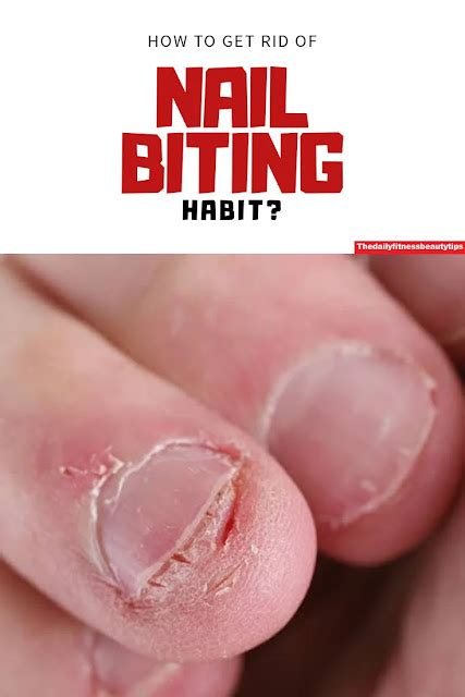 How To Stop Nail Biting Habit