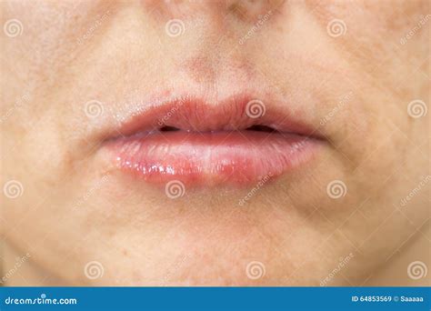 Closeup Of Woman Swelling Lips After Treatment Stock Image Image Of Attractive Human 64853569