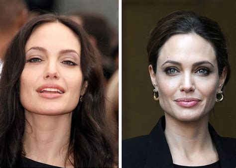 Angelina Jolies Beauty Secret Before And After Plastic Surgery
