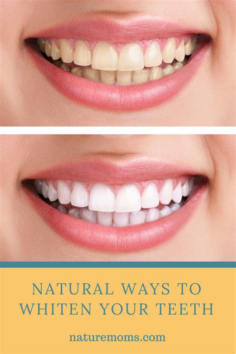 Mastering Minds Natural Ways To Whiten Your Teeth